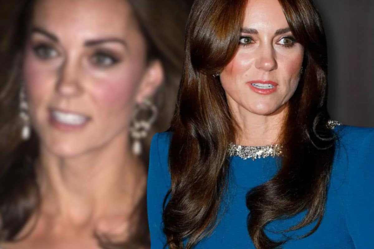 Kate: notizie sul suo stato di salute